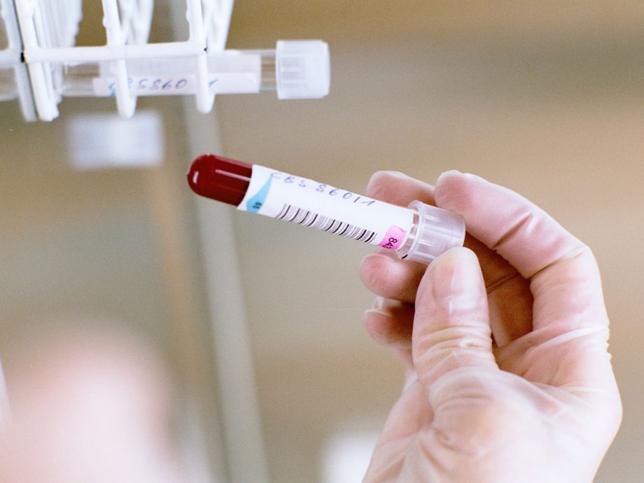 The picture shows a blood sample in the laboratory in a labelled tube held by a person. 